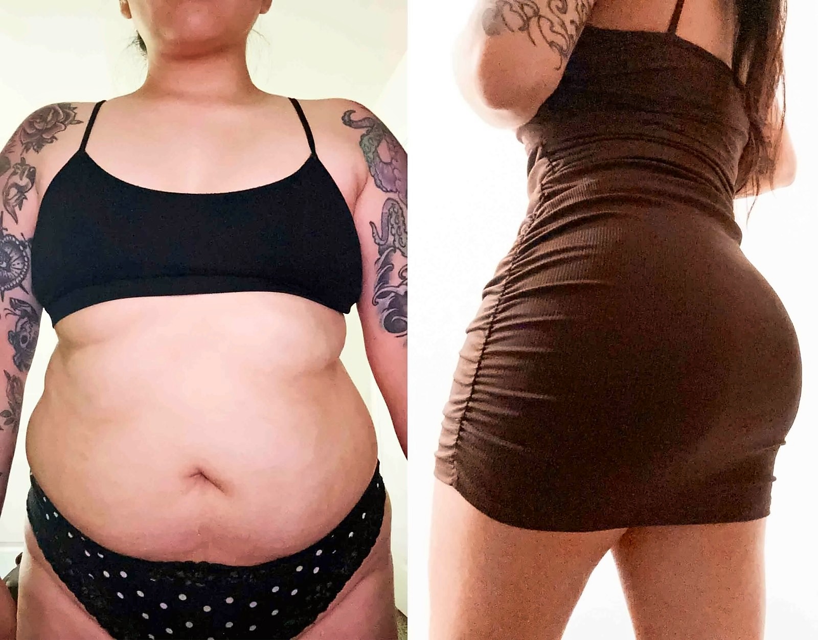 Before/After Fat Transfer, BBL before and after, actual patient of Dr. Long